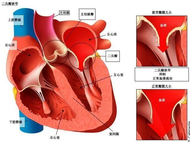 什么叫“窦性心律”？会影响身体吗？-第4张图片